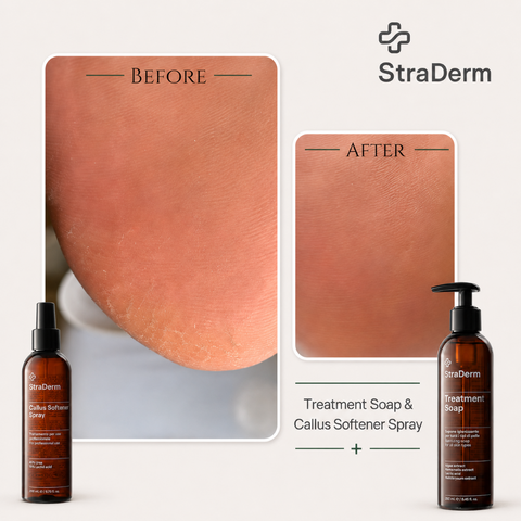 StraDerm Callus Softener Spray, 200 ml