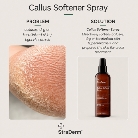 StraDerm Callus Softener Spray, 200 ml