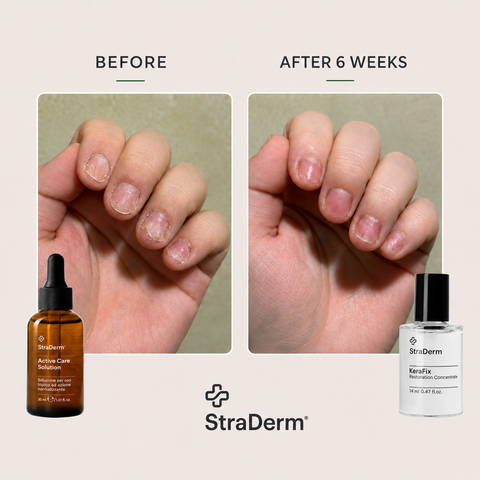 StraDerm Active Care Solution, 30 ml