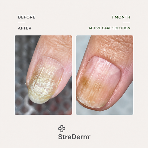 StraDerm Active Care Solution, 30 ml