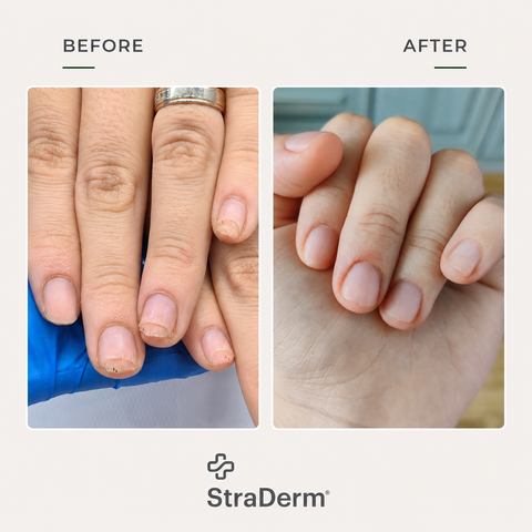 StraDerm Active Care Solution, 30 ml
