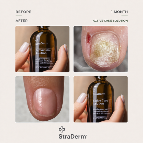StraDerm Active Care Solution, 30 ml
