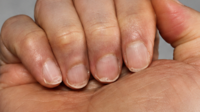If Your Nails Feel Soft and Bend Easily