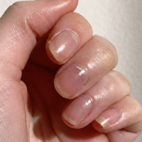 After