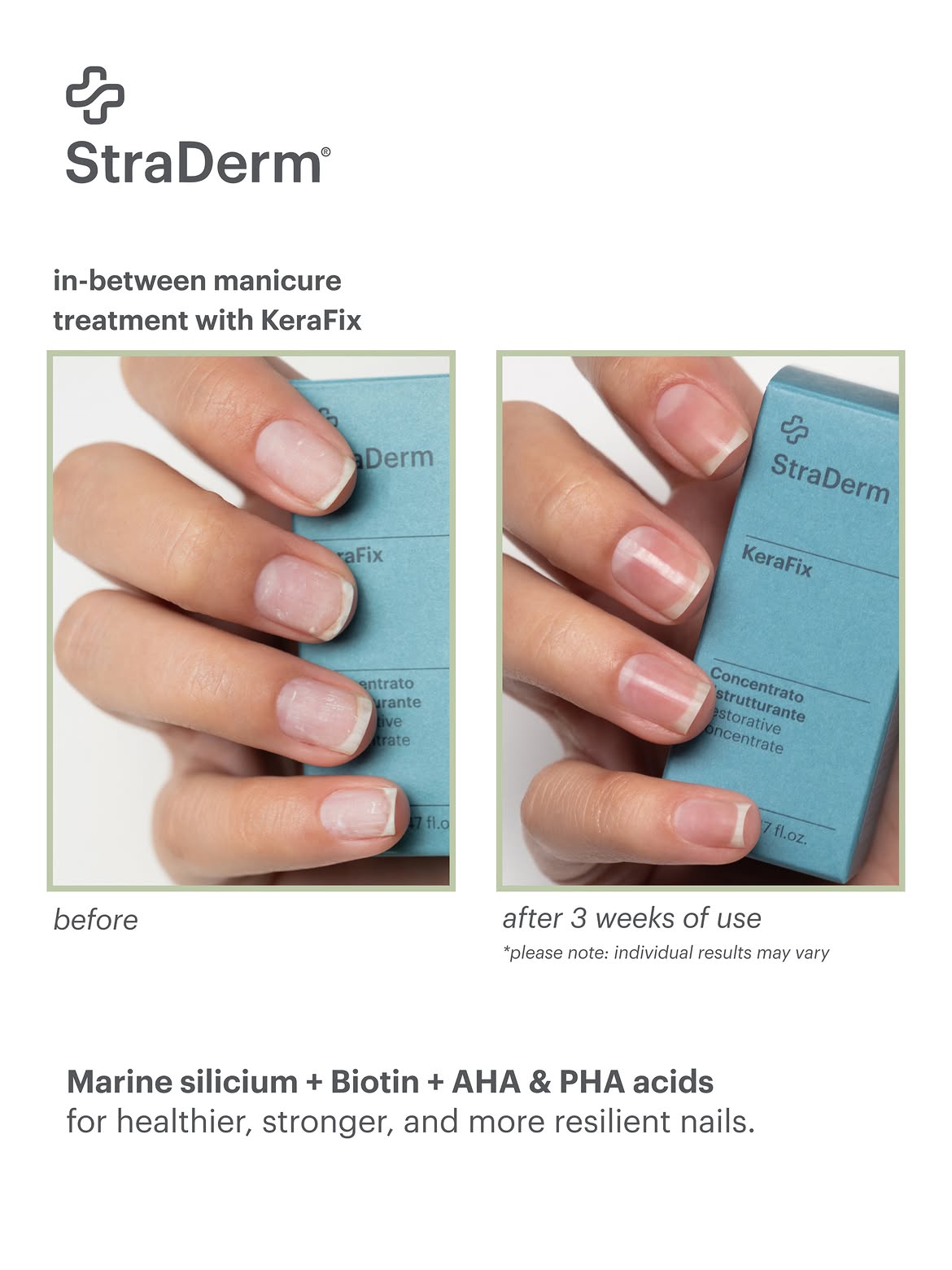 KeraFix, Intensive Nail Repair Concentrate, 14ml