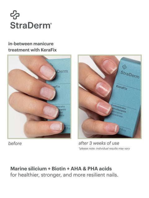 KeraFix, Intensive Nail Repair Concentrate, 14ml
